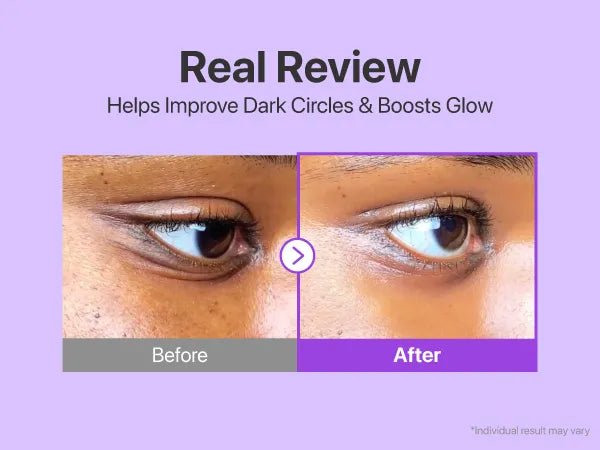 Numbuzin | Crema contorno de ojos No.9 NAD+ Retinol Volumetox