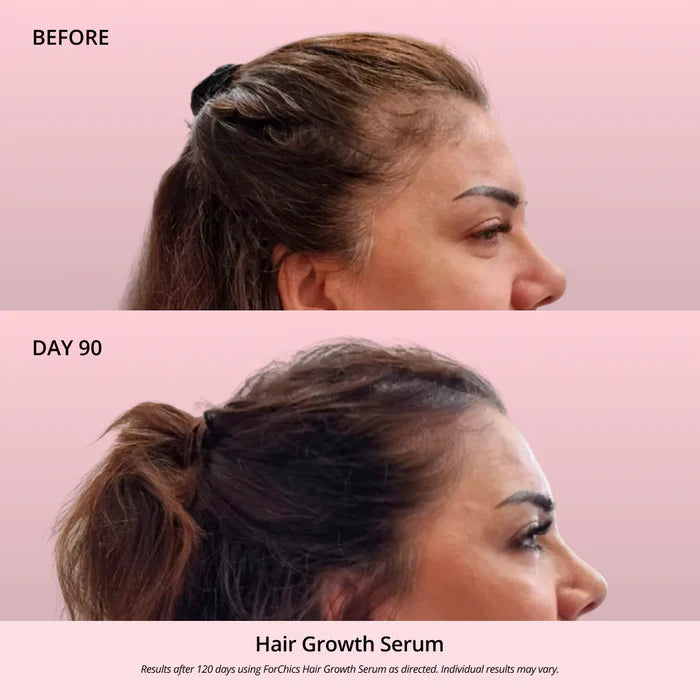 Serum aerosol para el crecimiento del cabello | Forchics
