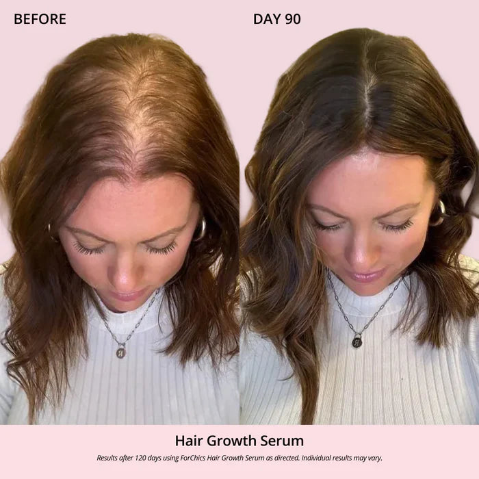 Serum aerosol para el crecimiento del cabello | Forchics
