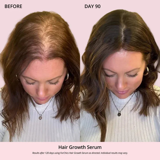 Serum aerosol para el crecimiento del cabello | Forchics