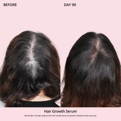 Serum aerosol para el crecimiento del cabello | Forchics