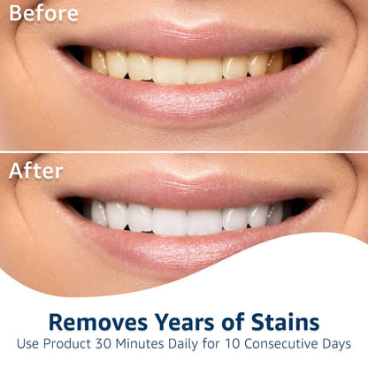 Cintas Blanqueadoras de Dientes | Equate