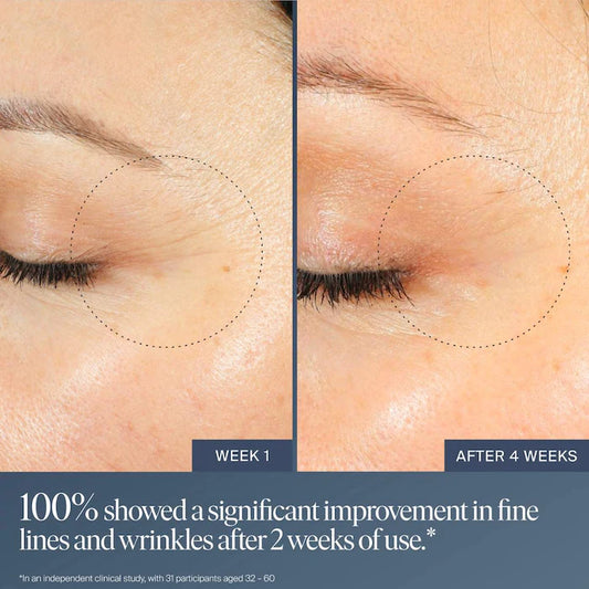 PREVENTA Jet Lag Overnight Eye Serum Summer Fridays